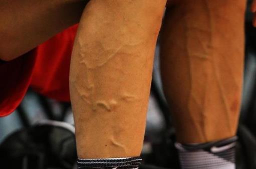 身上青筋凸起預示疾病風險 青筋暗示心血管疾病前兆