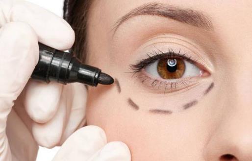 如何去眼袋 這些小妙招超管用