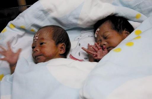 治新生兒黃疸 新生兒出現黃疸該如何護理