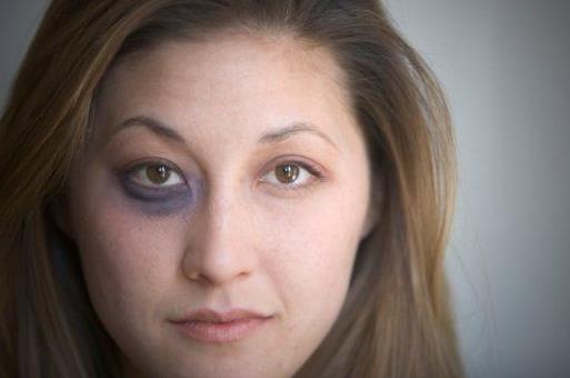 黑眼圈不僅是因為腎虛 黑眼圈透露你身體的健康問題