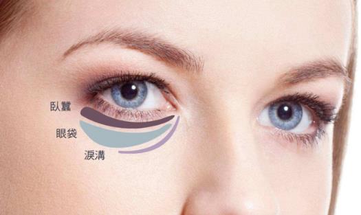 關于去除眼袋的三大誤區(qū) 別再做無用功