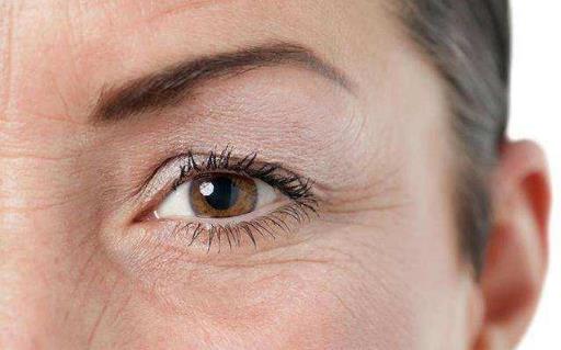 關于去除眼袋的三大誤區(qū) 別再做無用功