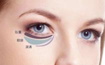 關于眼袋的三大誤區 去除眼袋別再做無用功