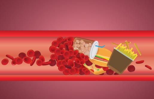 8種清潔血管食物分享