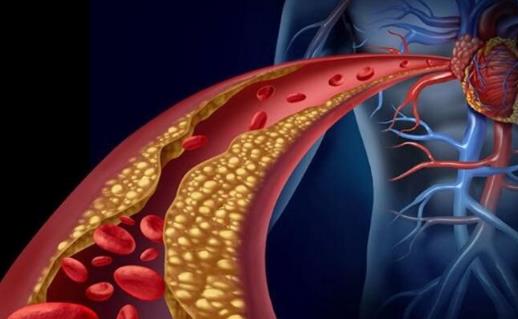血液粘稠后身體會出現(xiàn)哪些信號？