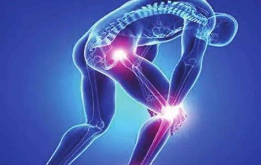 膝骨關節炎影響生活質量和運動能力 骨關節炎的預防