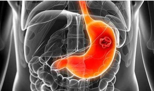 胃病三分治七分養(yǎng) 能養(yǎng)胃助消化的食物