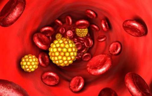 一旦查出血脂高，禁忌三物，做好二事，多喝一種水，血脂