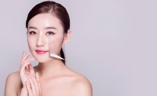 對祛痘有輔助作用的4類食物