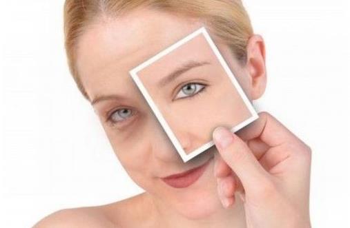 眼睛周圍這些疙瘩是什么?如何消除