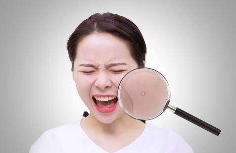 臉長痘痘遲遲不消?小心‘粉瘤’來襲