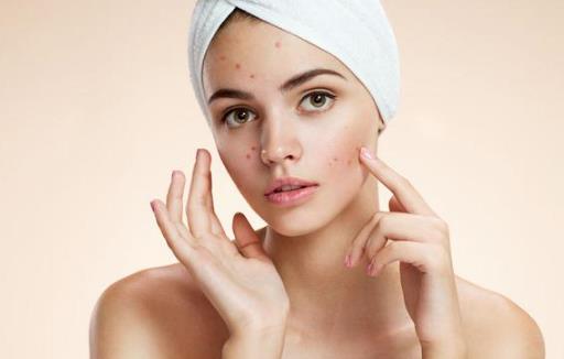 臉長痘痘遲遲不消?小心‘粉瘤’來襲