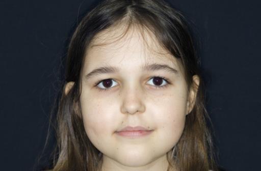 女性容易貧血?日常做到這5點能預防