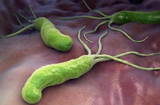 體內有幽門螺桿菌，身體往往有五個標志，占的越多，胃癌