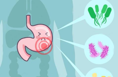 體內有幽門螺桿菌，身體往往有五個標志，占的越多，胃癌