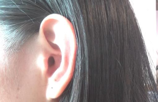 耳朵為什么有干濕的區別 簡單的耳朵護理方法