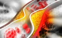 了解血管系統遠離血管疾病 讓血管恢復青春的保鮮劑 