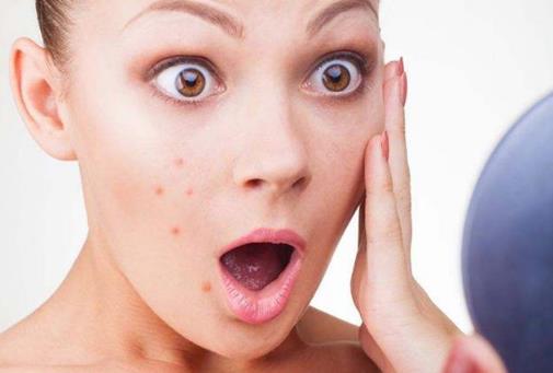 生理期總長痘 想經期也能美美的教你解決生理痘