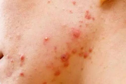 睡衣，床單，枕巾該多久清洗一次？超過這個時間，螨蟲會