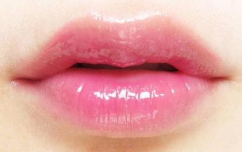 嘟嘟唇術(shù)后注意事項(xiàng)