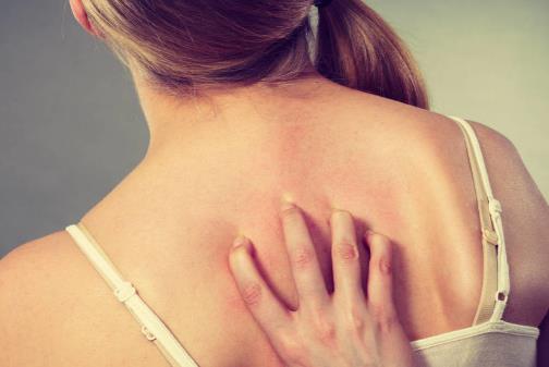 生理鹽水治皮膚過(guò)敏嗎 單純用鹽水不恰當(dāng)