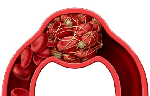 預防血栓 平時多吃這四大黑色食物