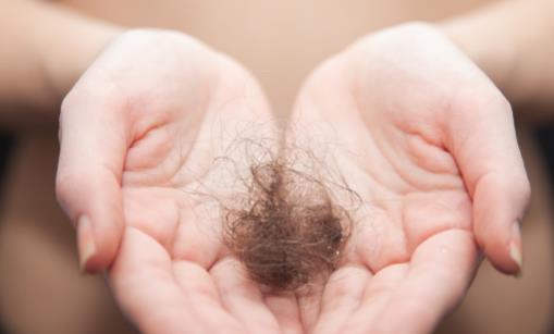 防止掉頭發除了食療還要做到這幾點