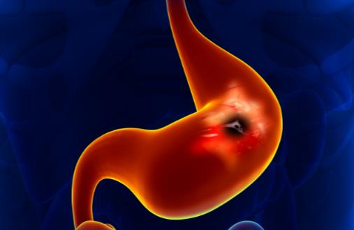 白衣服發黃怎么辦 去黃只要幾招就夠了