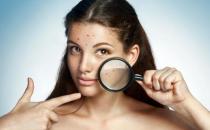 敏感肌護膚溫柔呵護是關鍵 過敏后的肌膚要降溫鎮定