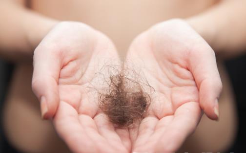 年輕人脫發(fā)嚴(yán)重 如何讓頭發(fā)濃密