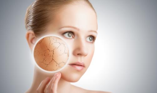 皮膚干燥脫皮怎么辦 4招幫你搞定它