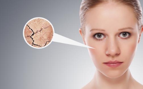 皮膚干燥脫皮怎么辦 4招幫你搞定它