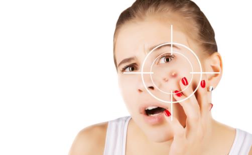 痘痘的調理不能盲目進行 10個民間快速有效祛痘小偏方 