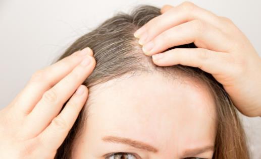 白發(fā)生長位置標志著臟腑健康 前額白發(fā)多為脾胃失調