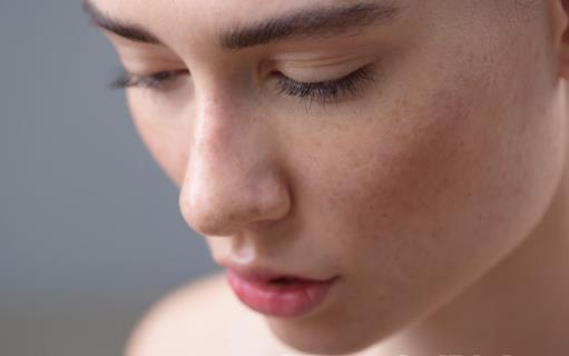 內外兼治祛除黃褐斑 去除黃褐斑食療方法