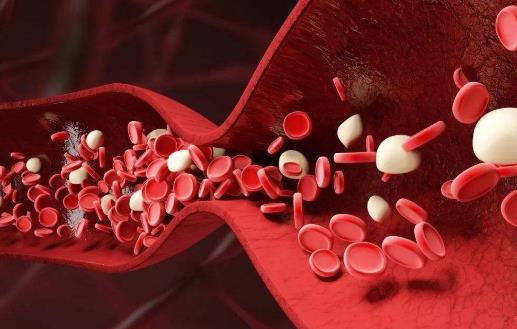 鉛中毒對機體的影響是全身性的 預防鉛中毒的措施