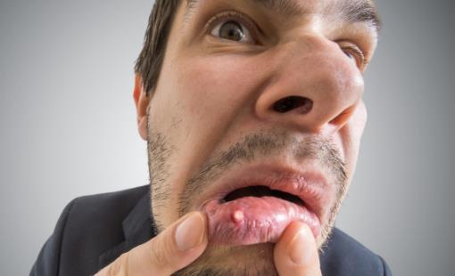 夏季炎熱很容易上火 幫你清熱瀉火的日常食譜