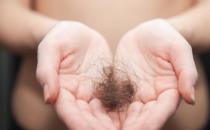 改善脫發是場持久戰 解決長期脫發問題有妙招