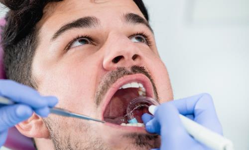 為了美白反而傷害牙齒?洗牙不是你想得那樣!