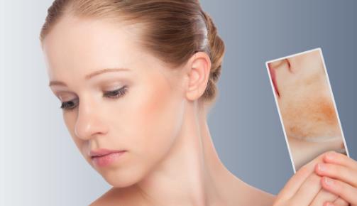 美肌五原則:濕·滑·緊·彈·色