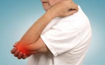 關節炎的護理非常重要 關節炎與環境的關系不可忽視