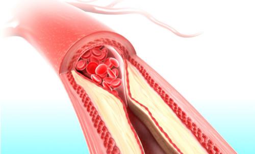 如何減少飲食中的脂肪量？這些方法你學(xué)會了嗎？