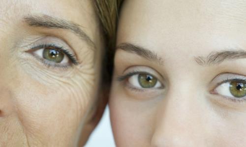 經(jīng)常笑容易長(zhǎng)眼尾紋嗎 魚(yú)尾紋該如何去除