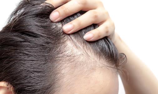 頭發少要怎么保養？四個問題要注意