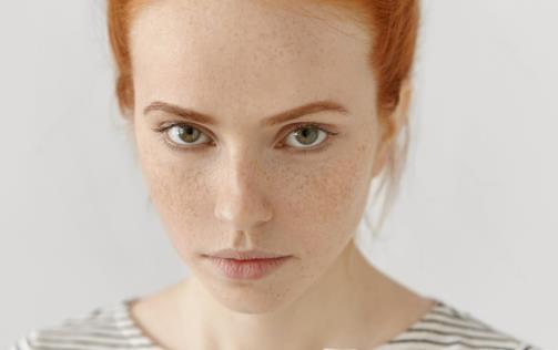 祛斑是美麗的天敵，如何去除祛斑