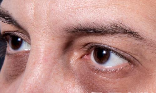 教你簡單按摩 擺脫厚重眼袋