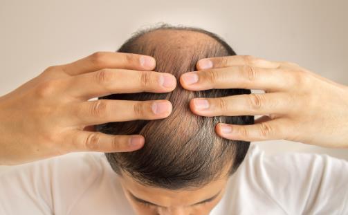 喝涼水都胖是因?yàn)槭裁?內(nèi)分泌失調(diào)食療方子推薦