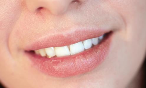 快來get唇部護理3不要法則 遠離護唇六大護理誤區