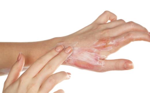 掌握急救小常識 避免意外導致的不良后果