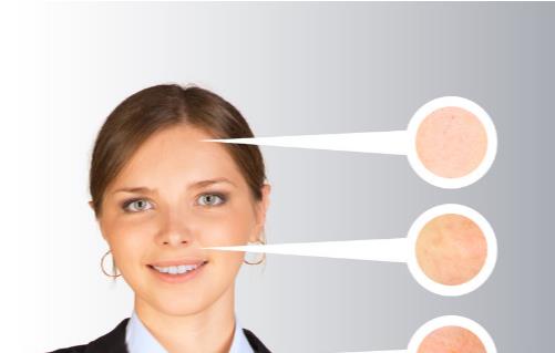 冬季女孩皮膚經常干燥 怎么補水保濕好